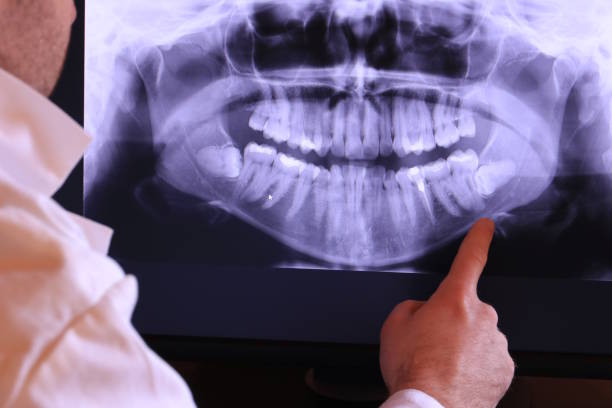 Best Emergency Dentist for Knocked-Out Tooth in Emmitsburg, MD
