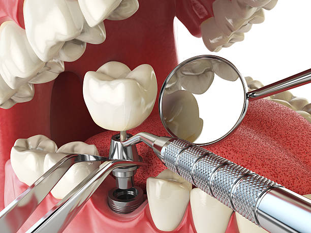 Best Pediatric Emergency Dentist in Emmitsburg, MD